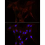 Immunofluorescence - Anti-LDL Receptor Antibody (A308995) - Antibodies.com