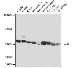 Western Blot - Anti-Glutathione Reductase Antibody [ARC1034] (A308996) - Antibodies.com