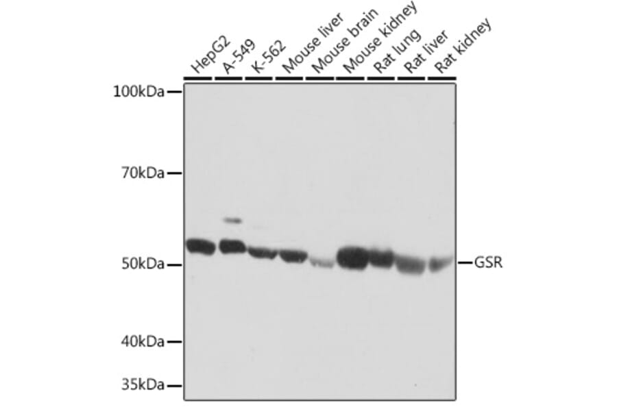 Western Blot - Anti-Glutathione Reductase Antibody [ARC1034] (A308996) - Antibodies.com