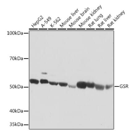 Western Blot - Anti-Glutathione Reductase Antibody [ARC1034] (A308996) - Antibodies.com