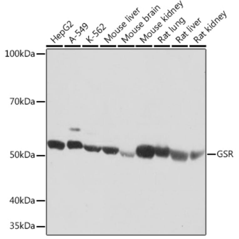 Western Blot - Anti-Glutathione Reductase Antibody [ARC1034] (A308996) - Antibodies.com