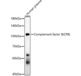 Western Blot - Anti-Complement factor B Antibody [ARC54100] (A308997) - Antibodies.com