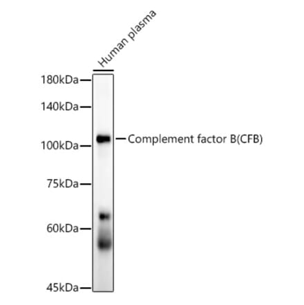 Western Blot - Anti-Complement factor B Antibody [ARC54100] (A308997) - Antibodies.com