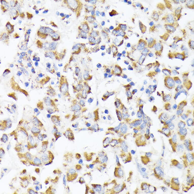 Immunohistochemistry - Anti-RHOG Antibody (A308998) - Antibodies.com