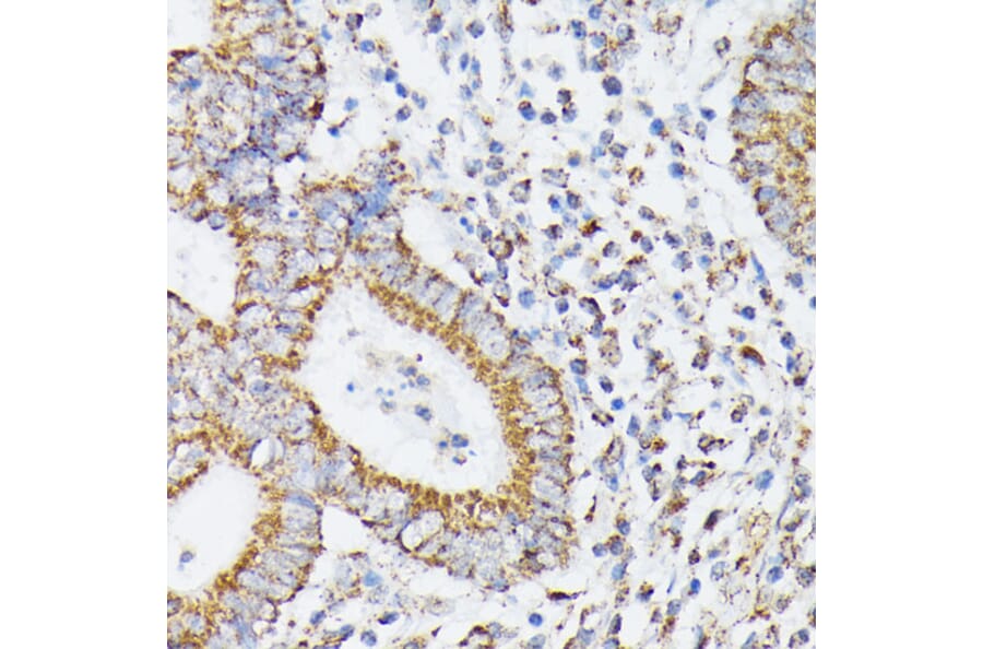 Immunohistochemistry - Anti-RHOG Antibody (A308998) - Antibodies.com