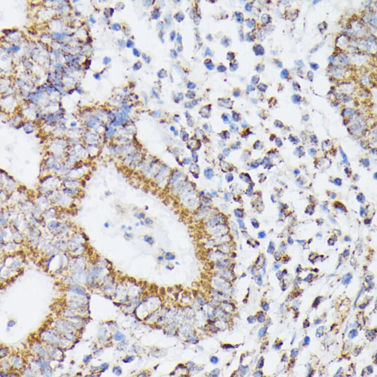 Immunohistochemistry - Anti-RHOG Antibody (A308998) - Antibodies.com