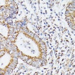 Immunohistochemistry - Anti-RHOG Antibody (A308998) - Antibodies.com