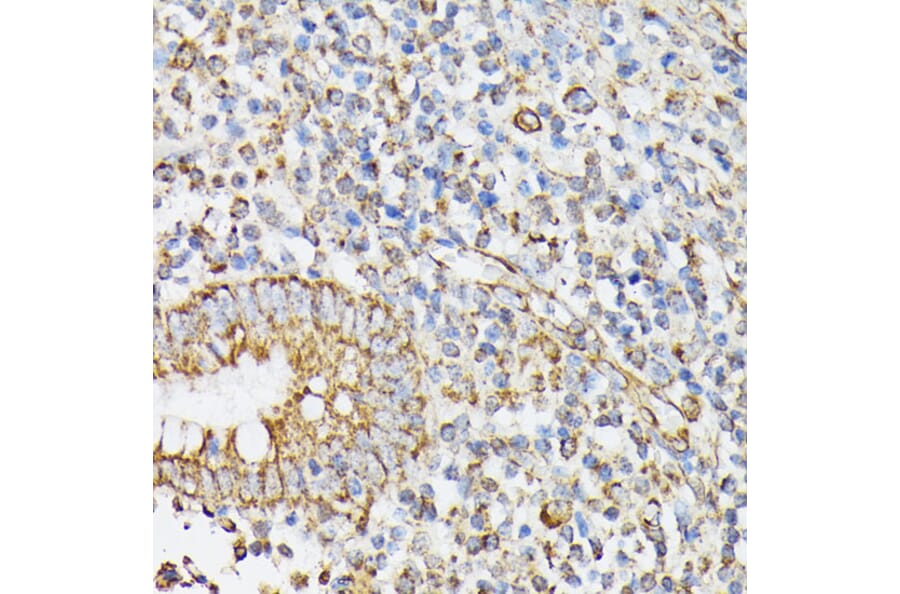 Immunohistochemistry - Anti-RHOG Antibody (A308998) - Antibodies.com
