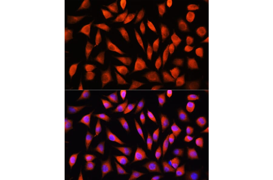 Immunofluorescence - Anti-RHOG Antibody (A308998) - Antibodies.com