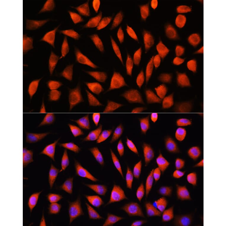 Immunofluorescence - Anti-RHOG Antibody (A308998) - Antibodies.com