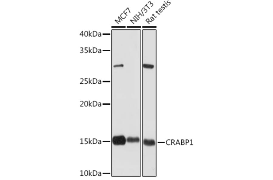 Western Blot - Anti-CRABP1 Antibody [ARC1991] (A308999) - Antibodies.com