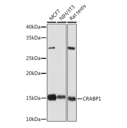 Western Blot - Anti-CRABP1 Antibody [ARC1991] (A308999) - Antibodies.com