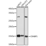 Western Blot - Anti-CRABP1 Antibody [ARC1991] (A308999) - Antibodies.com