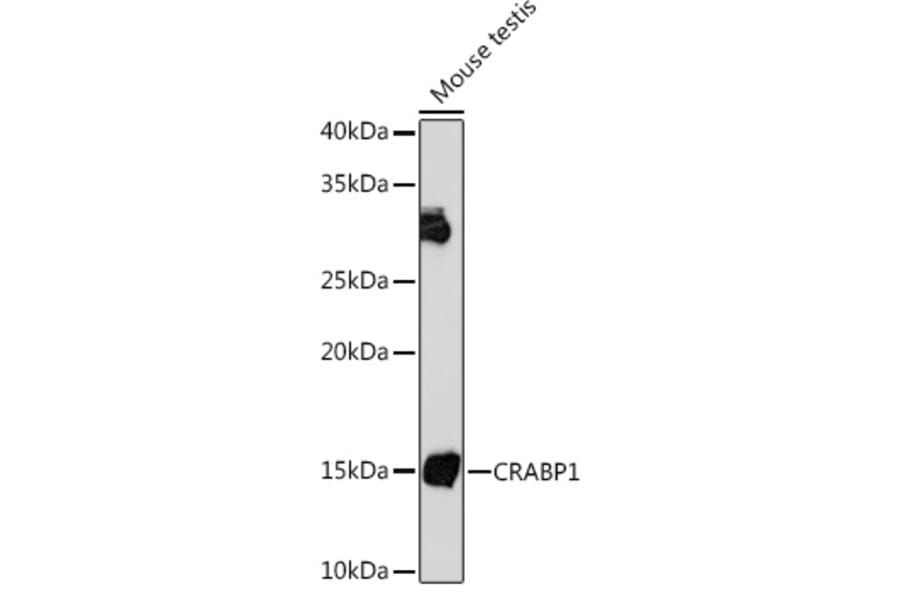 Western Blot - Anti-CRABP1 Antibody [ARC1991] (A308999) - Antibodies.com