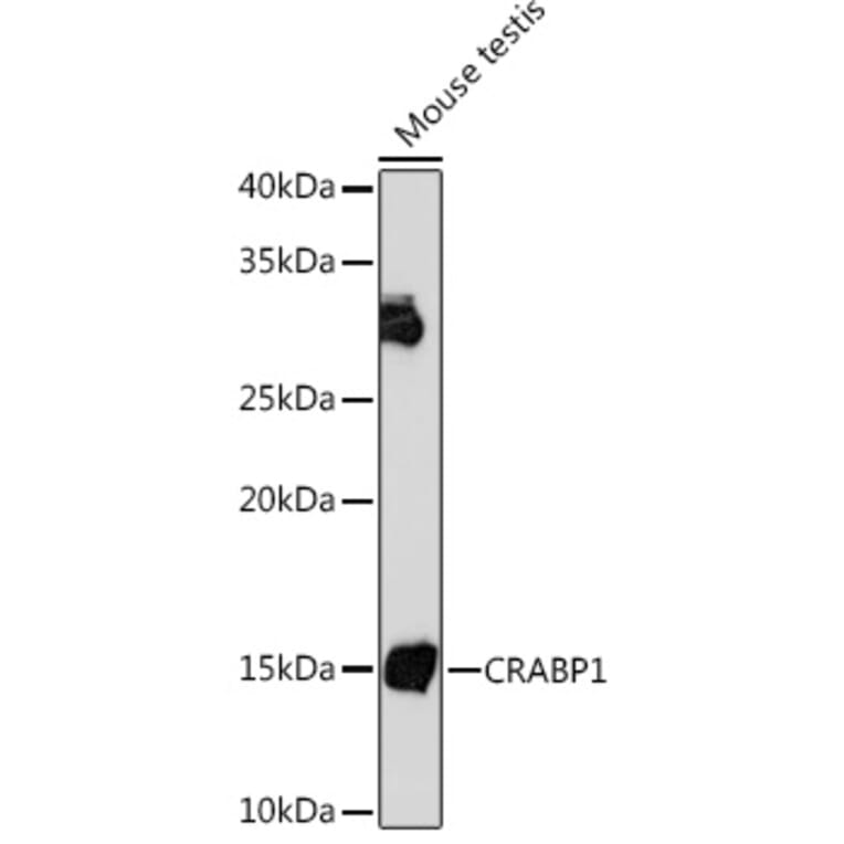 Western Blot - Anti-CRABP1 Antibody [ARC1991] (A308999) - Antibodies.com