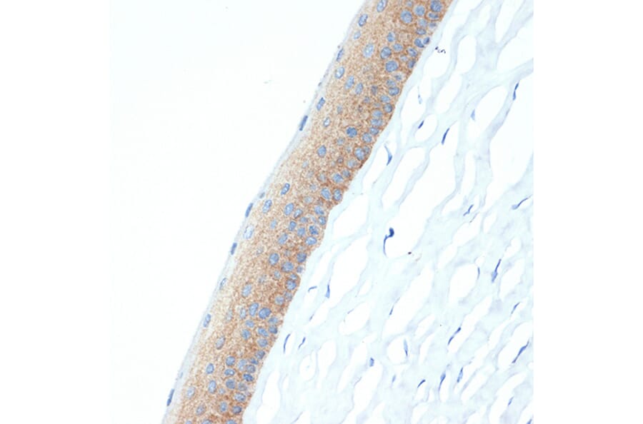 Immunohistochemistry - Anti-CRABP1 Antibody [ARC1991] (A308999) - Antibodies.com