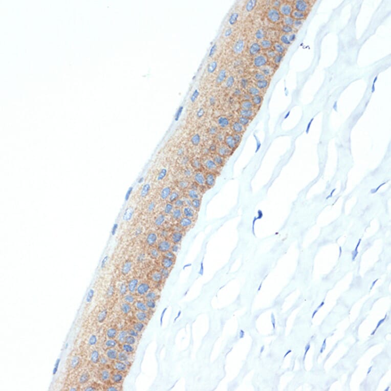 Immunohistochemistry - Anti-CRABP1 Antibody [ARC1991] (A308999) - Antibodies.com