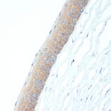 Immunohistochemistry - Anti-CRABP1 Antibody [ARC1991] (A308999) - Antibodies.com