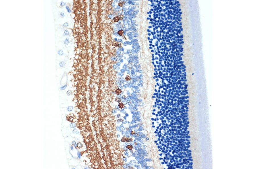 Immunohistochemistry - Anti-CRABP1 Antibody [ARC1991] (A308999) - Antibodies.com