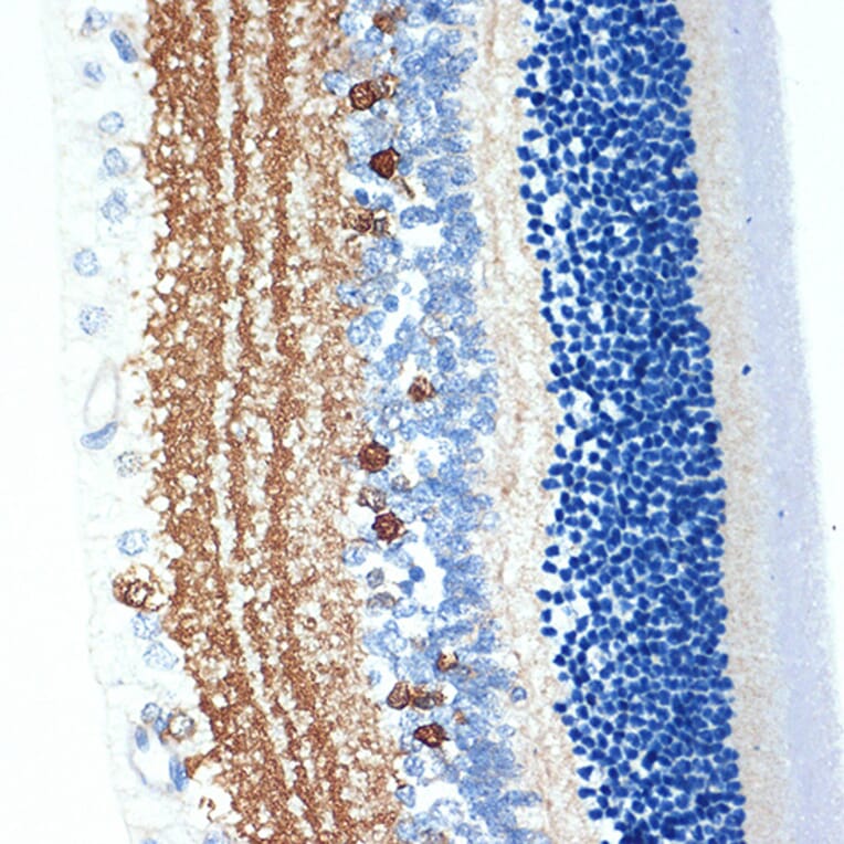 Immunohistochemistry - Anti-CRABP1 Antibody [ARC1991] (A308999) - Antibodies.com