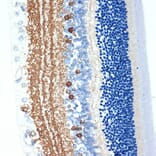 Immunohistochemistry - Anti-CRABP1 Antibody [ARC1991] (A308999) - Antibodies.com