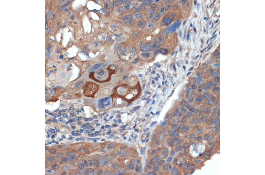 Immunohistochemistry - Anti-CRABP1 Antibody [ARC1991] (A308999) - Antibodies.com