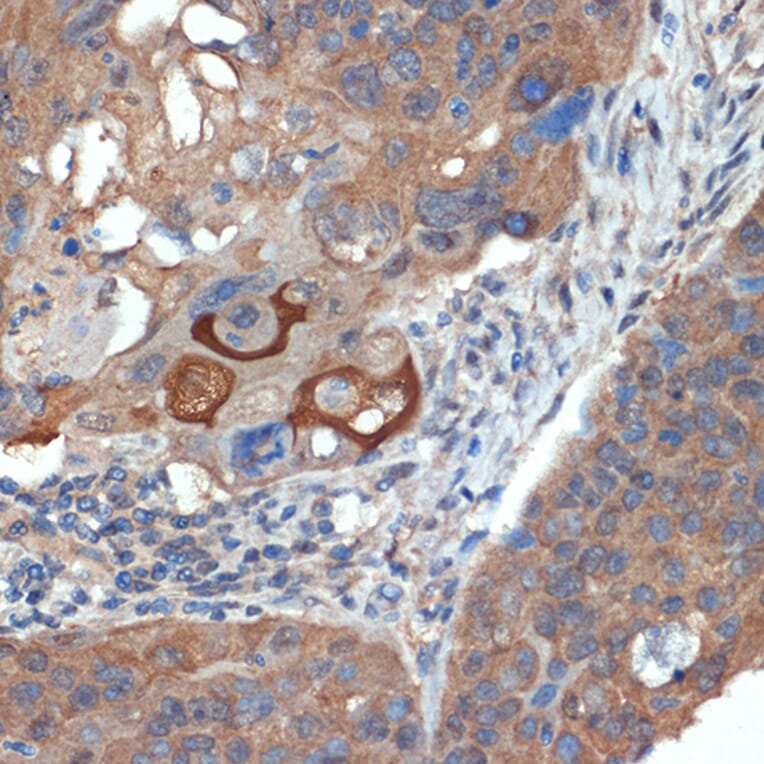 Immunohistochemistry - Anti-CRABP1 Antibody [ARC1991] (A308999) - Antibodies.com
