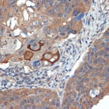 Immunohistochemistry - Anti-CRABP1 Antibody [ARC1991] (A308999) - Antibodies.com
