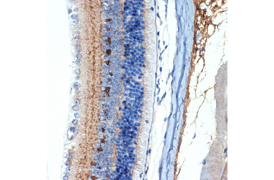 Immunohistochemistry - Anti-CRABP1 Antibody [ARC1991] (A308999) - Antibodies.com