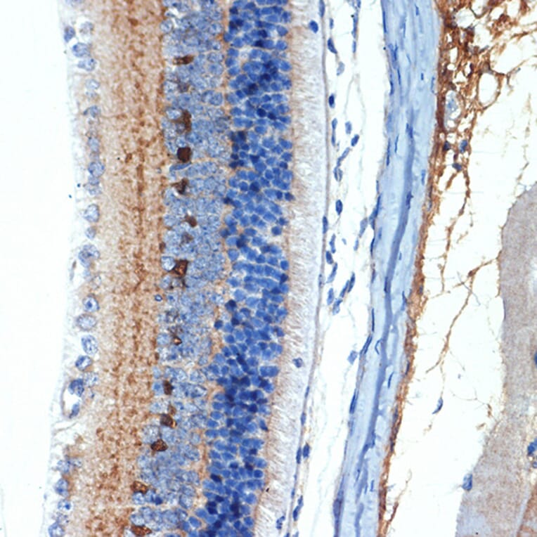 Immunohistochemistry - Anti-CRABP1 Antibody [ARC1991] (A308999) - Antibodies.com