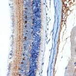 Immunohistochemistry - Anti-CRABP1 Antibody [ARC1991] (A308999) - Antibodies.com
