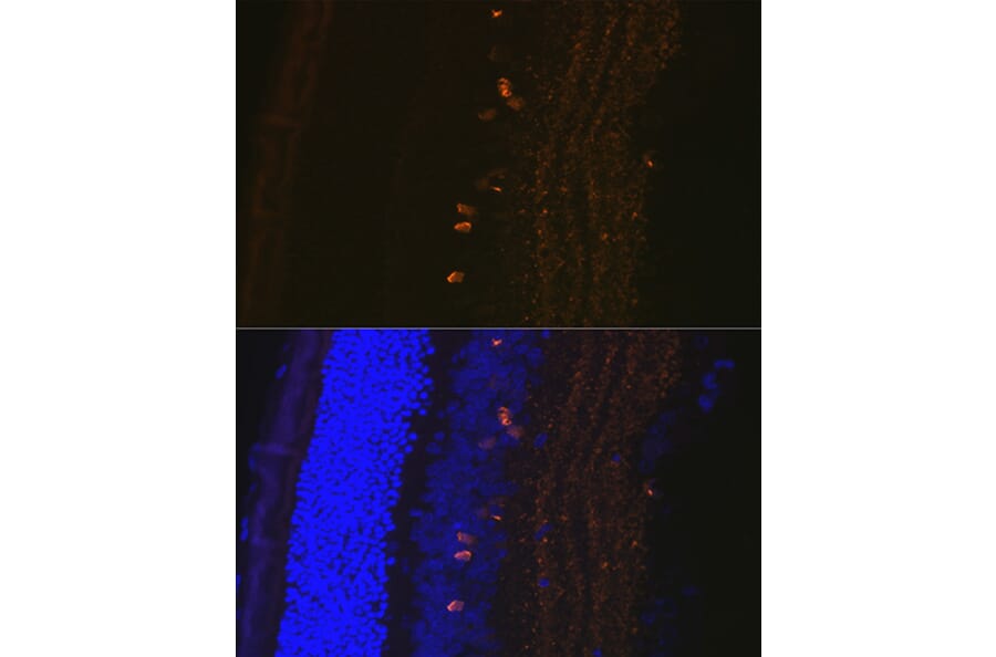 Immunofluorescence - Anti-CRABP1 Antibody [ARC1991] (A308999) - Antibodies.com