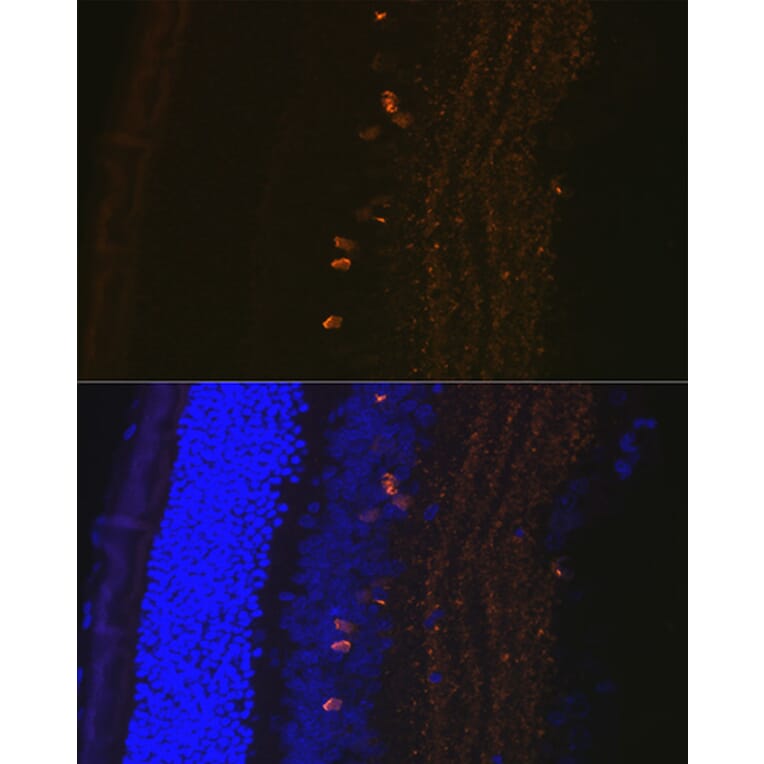 Immunofluorescence - Anti-CRABP1 Antibody [ARC1991] (A308999) - Antibodies.com