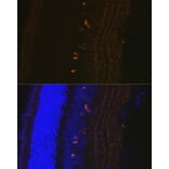 Immunofluorescence - Anti-CRABP1 Antibody [ARC1991] (A308999) - Antibodies.com