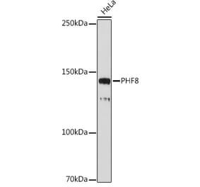 Western Blot - Anti-PHF8 Antibody (A309000) - Antibodies.com