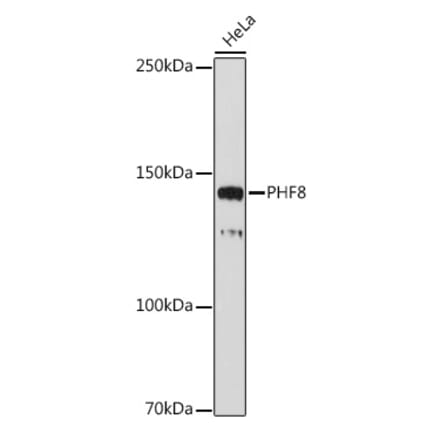 Western Blot - Anti-PHF8 Antibody [ARC2306] (A309000) - Antibodies.com