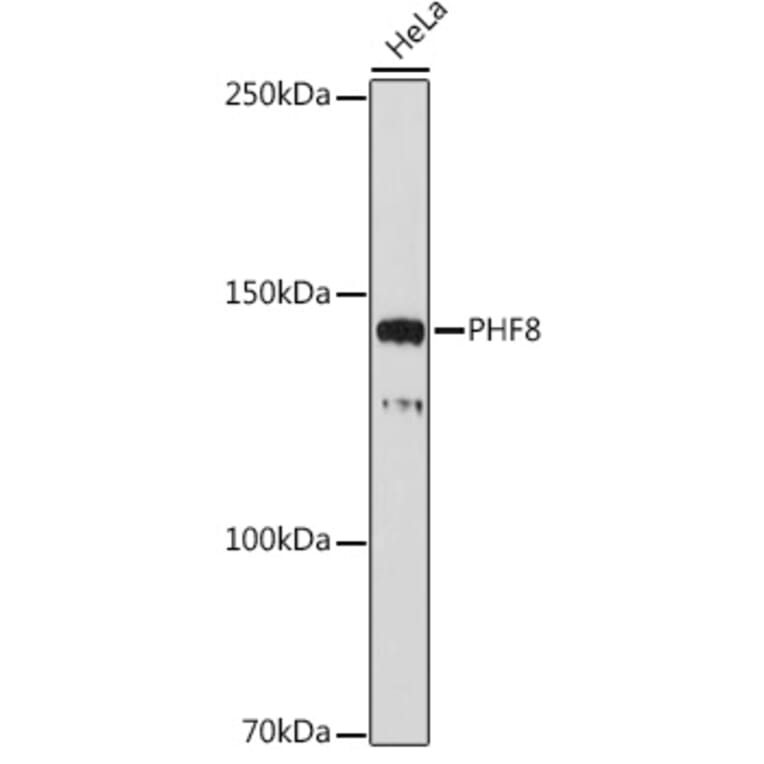 Western Blot - Anti-PHF8 Antibody [ARC2306] (A309000) - Antibodies.com