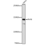 Western Blot - Anti-PHF8 Antibody [ARC2306] (A309000) - Antibodies.com