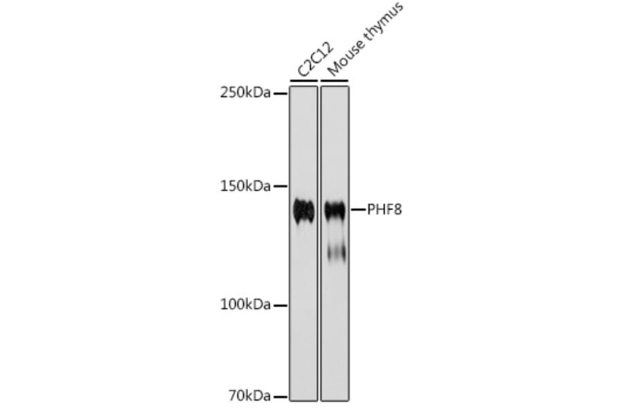 Western Blot - Anti-PHF8 Antibody [ARC2306] (A309000) - Antibodies.com