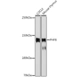 Western Blot - Anti-PHF8 Antibody [ARC2306] (A309000) - Antibodies.com