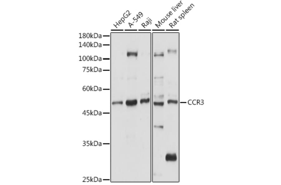 Western Blot - Anti-CCR3 Antibody (A309001) - Antibodies.com