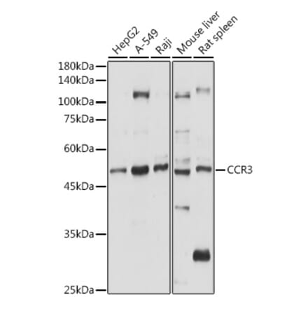 Western Blot - Anti-CCR3 Antibody (A309001) - Antibodies.com