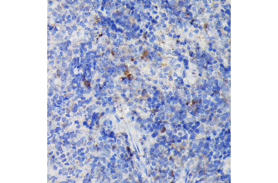 Immunohistochemistry - Anti-CCR3 Antibody (A309001) - Antibodies.com