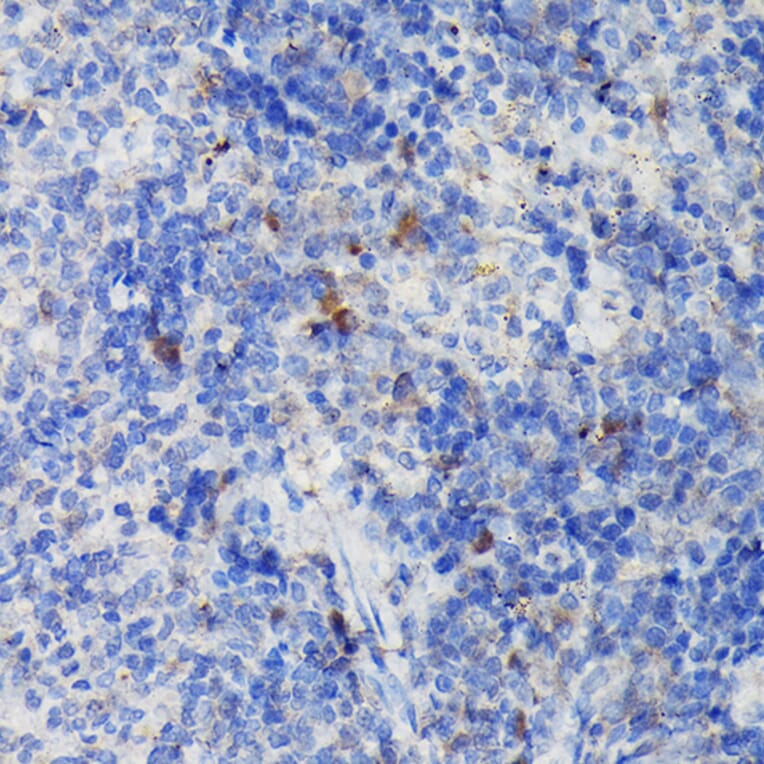 Immunohistochemistry - Anti-CCR3 Antibody (A309001) - Antibodies.com