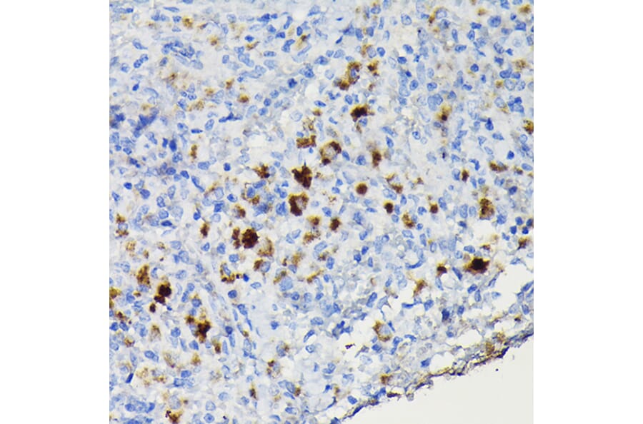 Immunohistochemistry - Anti-CCR3 Antibody (A309001) - Antibodies.com