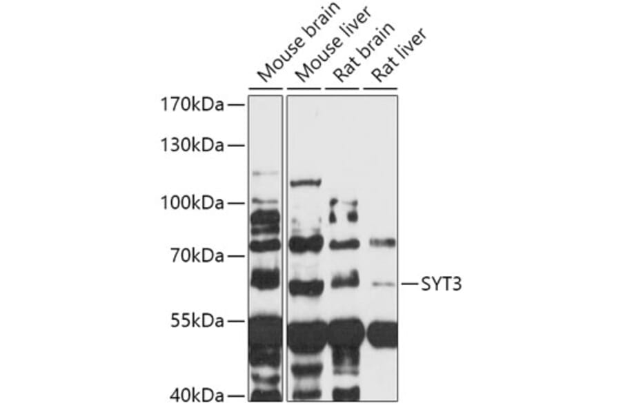 Western Blot - Anti-Synaptotagmin Antibody (A309002) - Antibodies.com