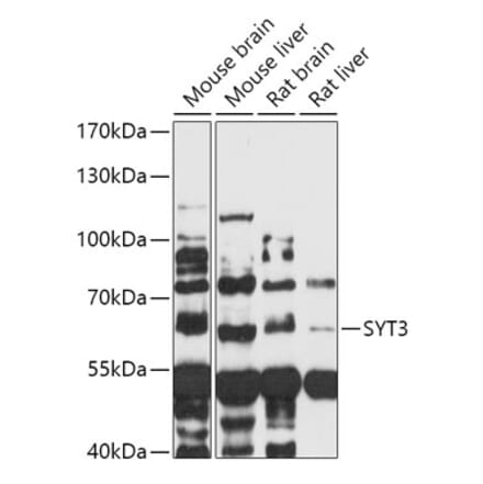 Western Blot - Anti-Synaptotagmin Antibody (A309002) - Antibodies.com