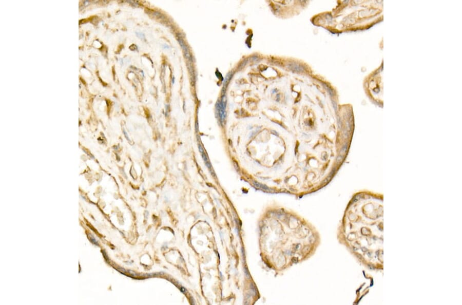 Immunohistochemistry - Anti-TGF beta Receptor II Antibody [ARC57218] (A309003) - Antibodies.com