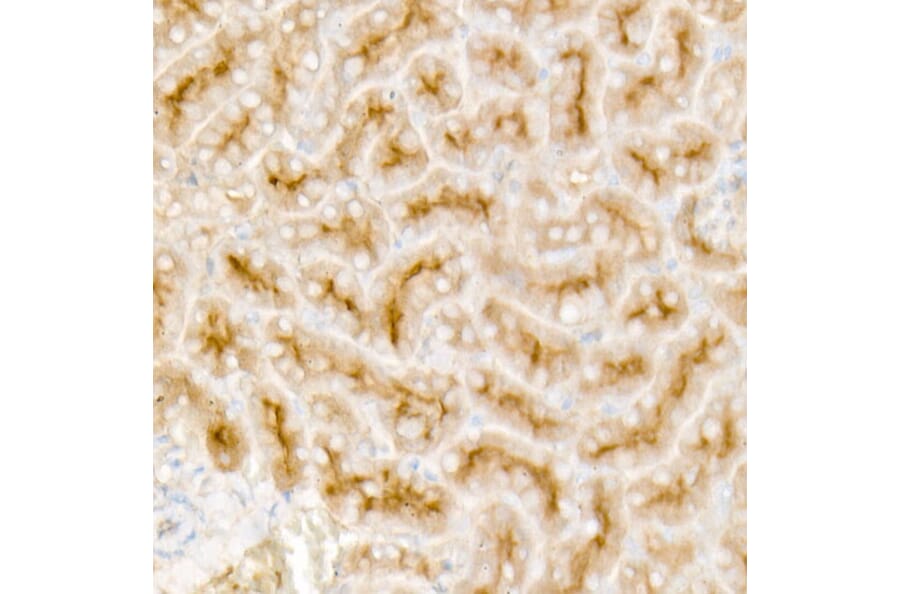 Immunohistochemistry - Anti-TGF beta Receptor II Antibody [ARC57218] (A309003) - Antibodies.com