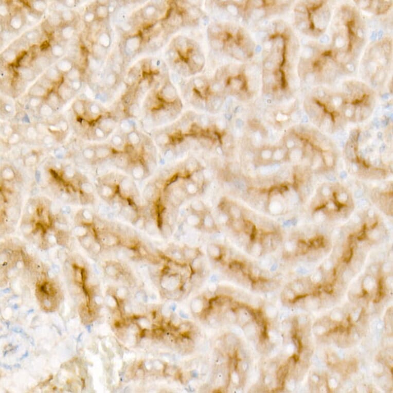 Immunohistochemistry - Anti-TGF beta Receptor II Antibody [ARC57218] (A309003) - Antibodies.com